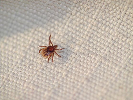 babesiosis