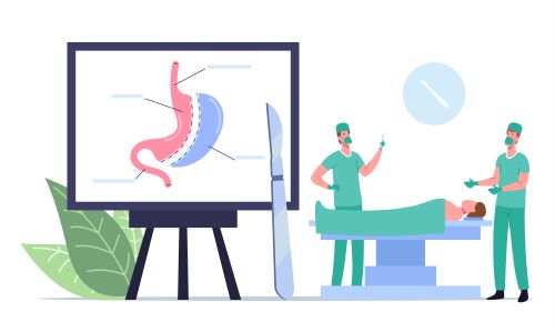 Health Insurance Cover Bariatric Surgery