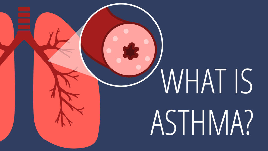 Symptoms of Asthma Signs, Diagnosis, Prevention & Treatment