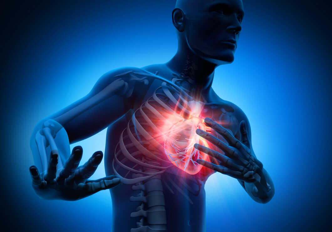 Heart Attack: Symptoms, Causes, Warning Signs & Treatment