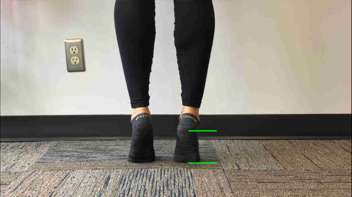 Gait Training Steps, Benefits & Safety Precautions