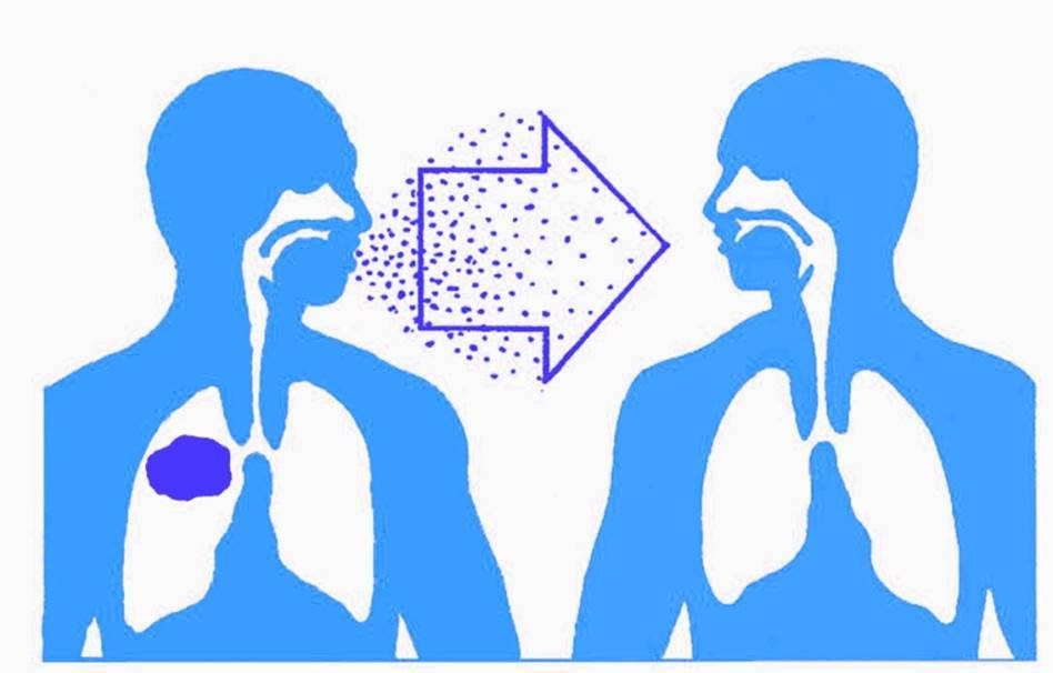 Tuberculosis Symptoms, Causes, Treatment & Prevention