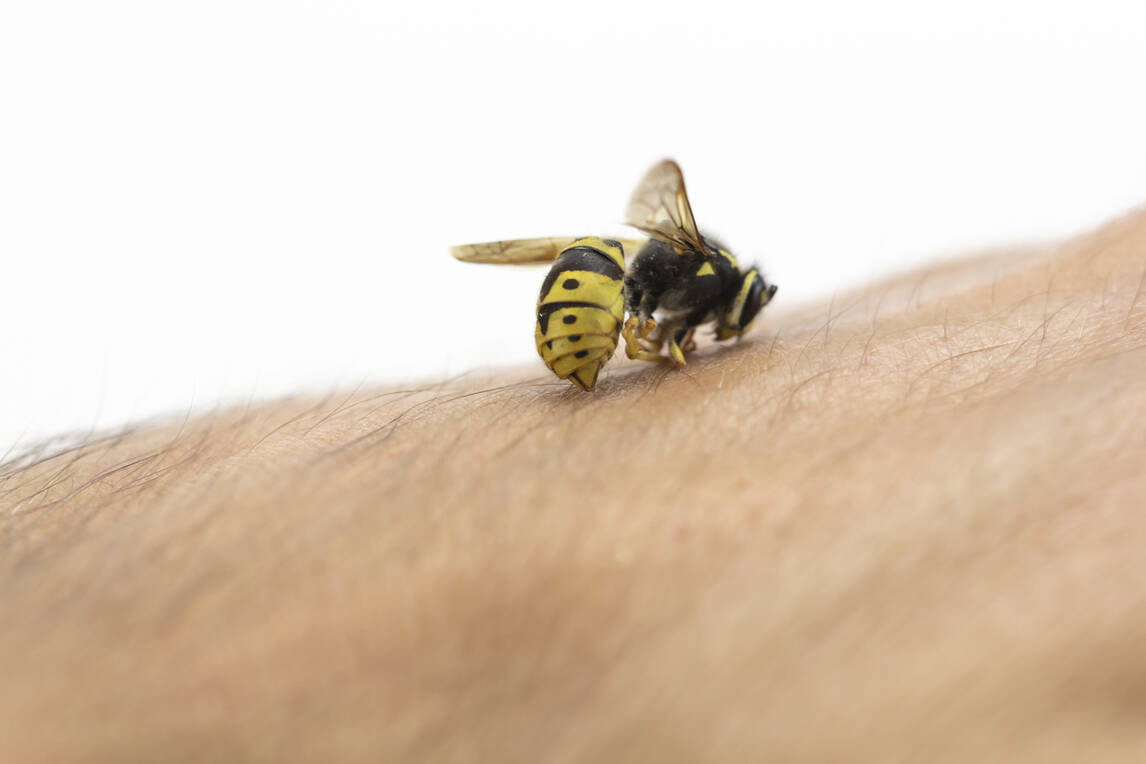 Insect Bite Allergy Causes, Symptoms, Insect Bite Allergy Treatment