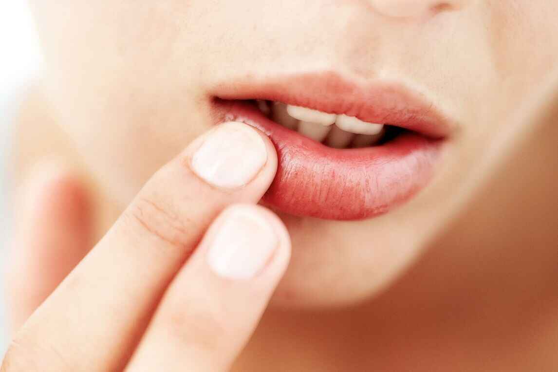 symptoms-of-allergic-reaction-to-lipstick-lipstutorial
