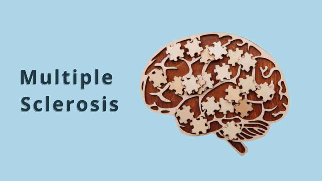 Multiple Sclerosis Symptoms, Causes, Types, Treatment & Prevention