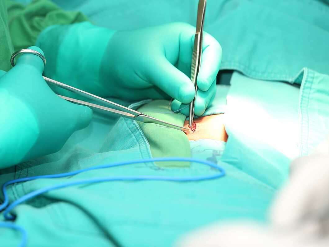 What Is Hernia Surgery Types & Average Treatment Cost