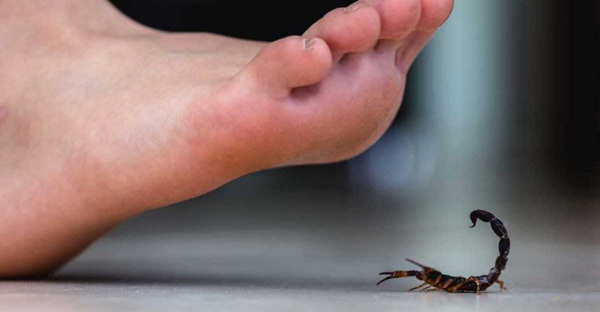 scorpion sting symptoms duration