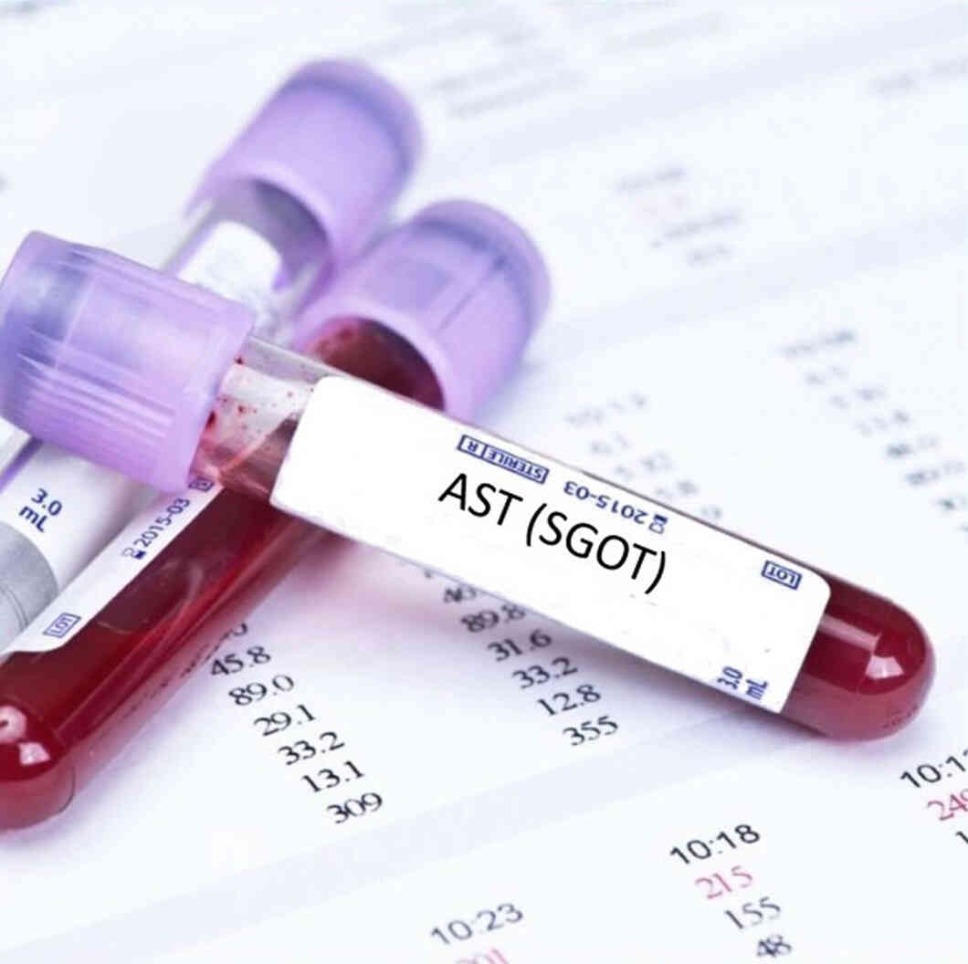 SGOT blood test Meaning, Uses & Different Ranges