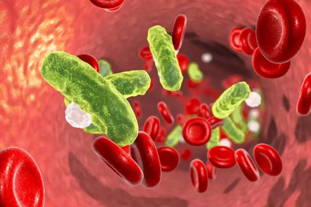 What is Septicemia Causes, Symptoms, and Treatment