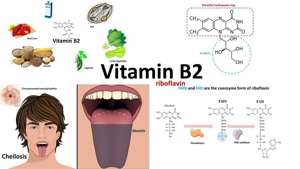 Signs And Symptoms Of A Vitamin B2 Riboflavin Deficiency 57 OFF