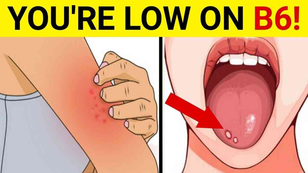 Vitamin B6 Deficiency Symptoms, Causes, Treatment & Prevention (2022)
