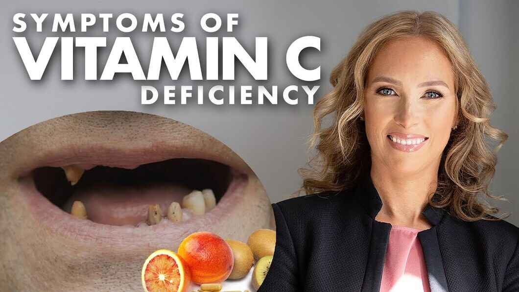 Plochý jar T vitamin c deficiency symptoms dohľad spolužiak štandardné