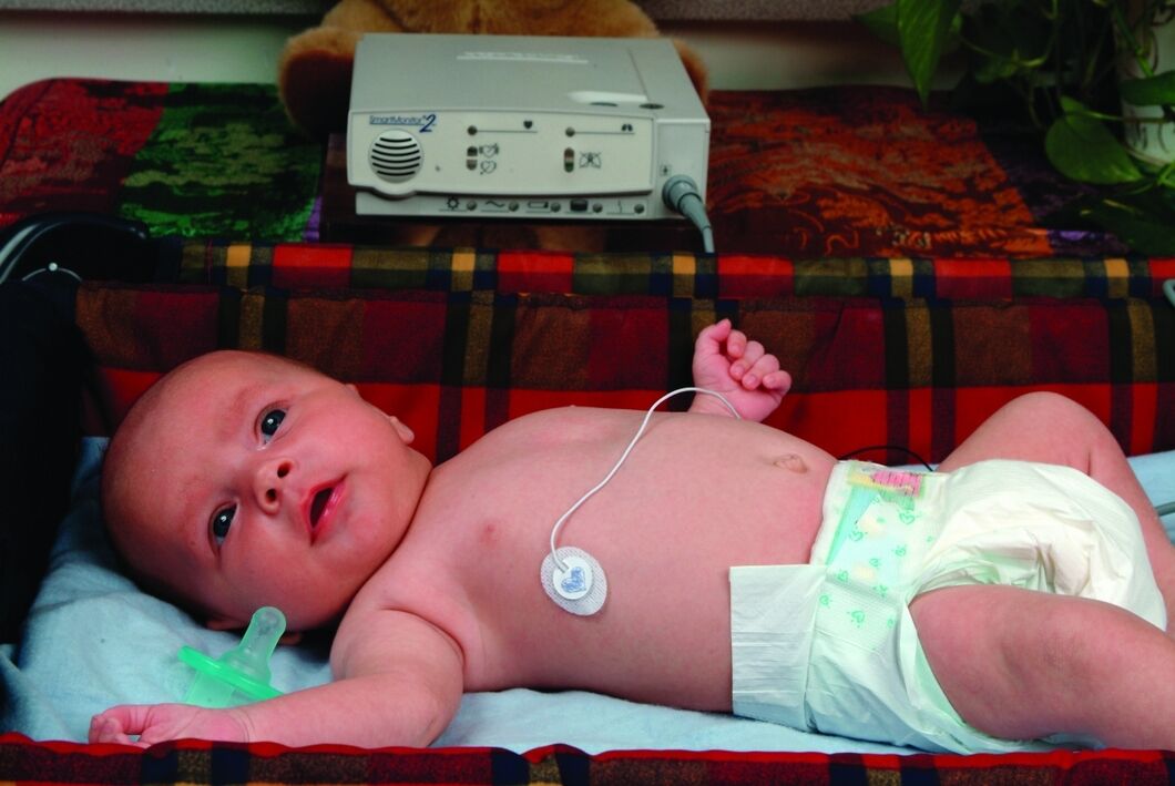 Apnea Monitor Types, Working Principle And Uses