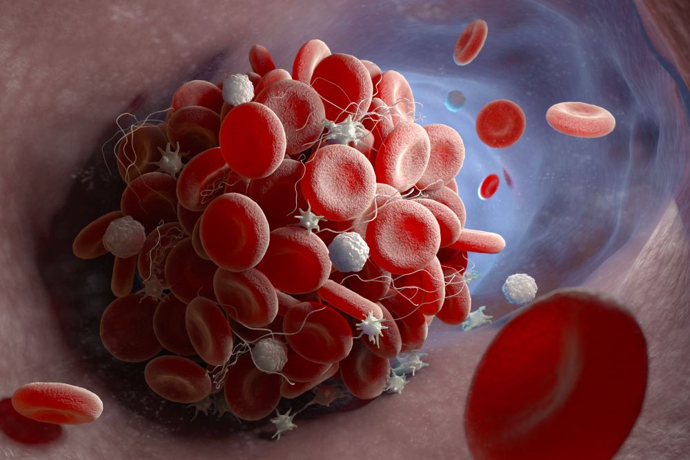 formation-of-a-blood-clot