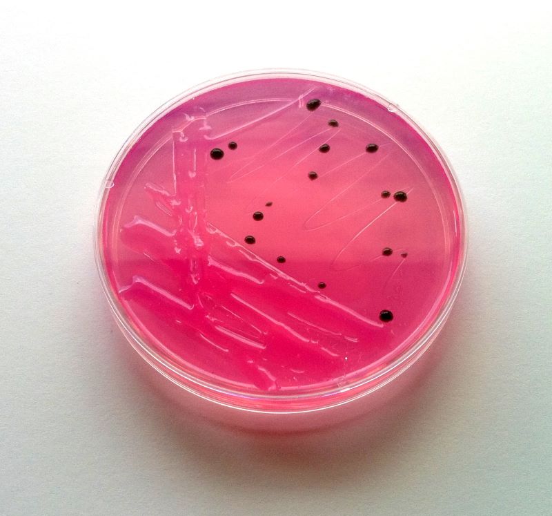 salmonellosis-disease