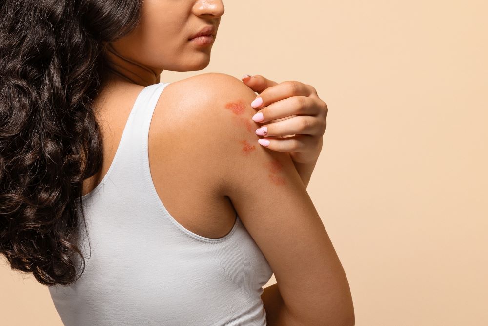 unhappy-young-woman-scratching-her-irritated-skin