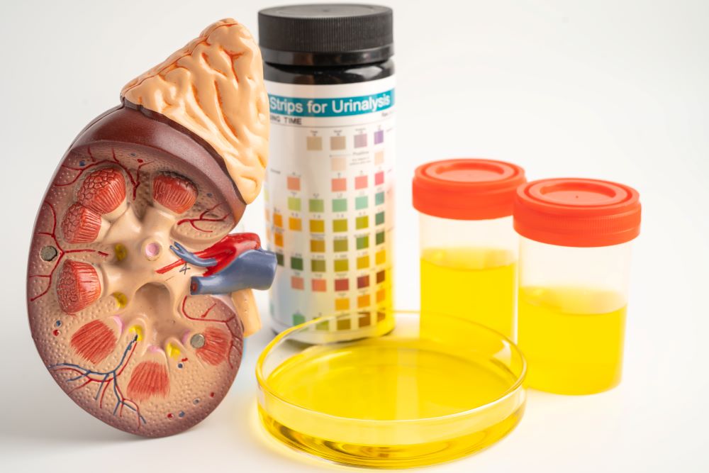urinalysis-kidney-model-and-urine-cup